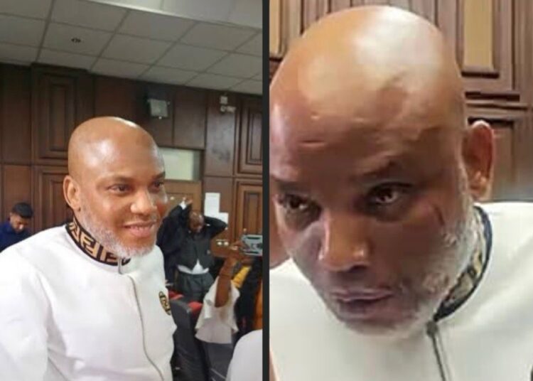 Nnamdi Kanu Has Case To Answer, Says Court, Rejects bid for transfer to Nat'l hospital